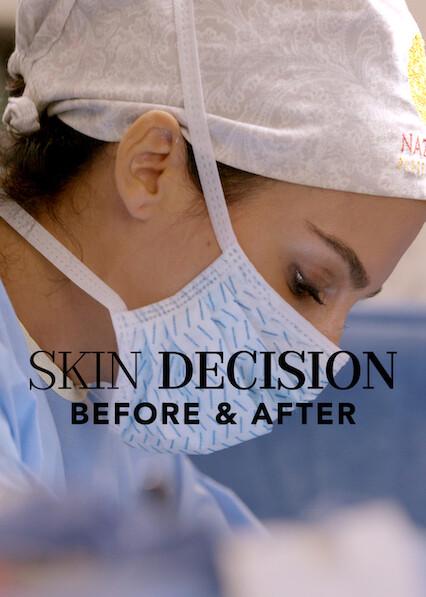 Skin Decision: Before and After